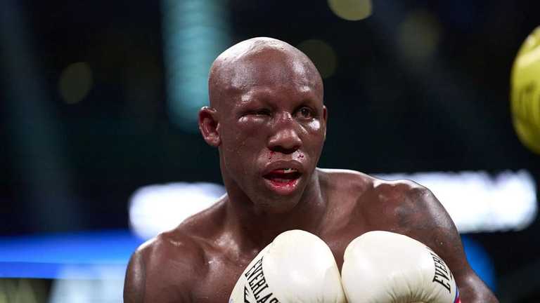 Угас зі зламаною очницею / Фото Getty Images Угас зі зламаною очницею / Фото Getty Images