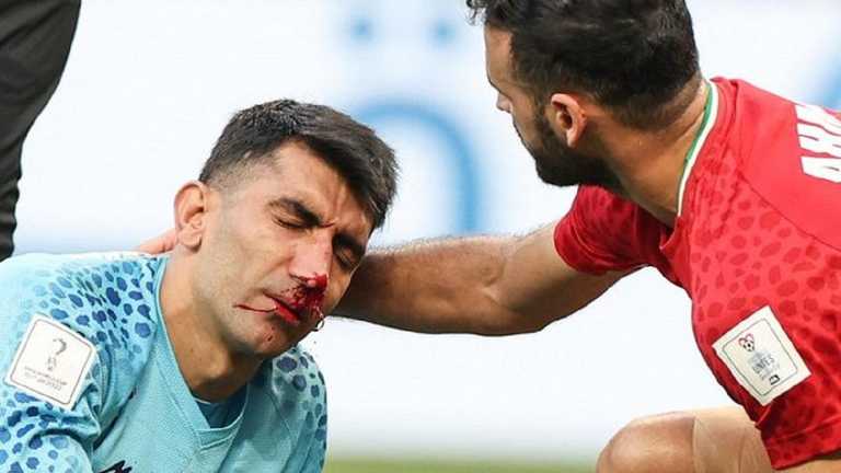 Алиреза Бейранванд / Фото Getty Images Алиреза Бейранванд / Фото Getty Images