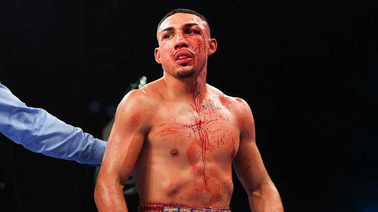 Теофімо Лопес / Фото Top Rank Теофімо Лопес / Фото Top Rank