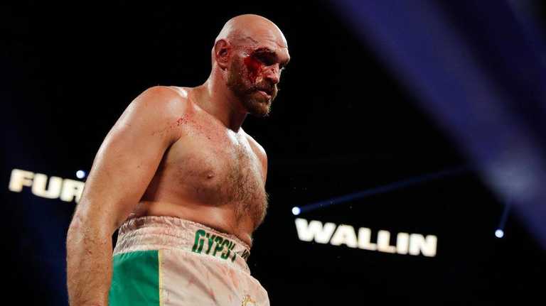 Тайсон Ф'юрі / фото з відкритих джерел