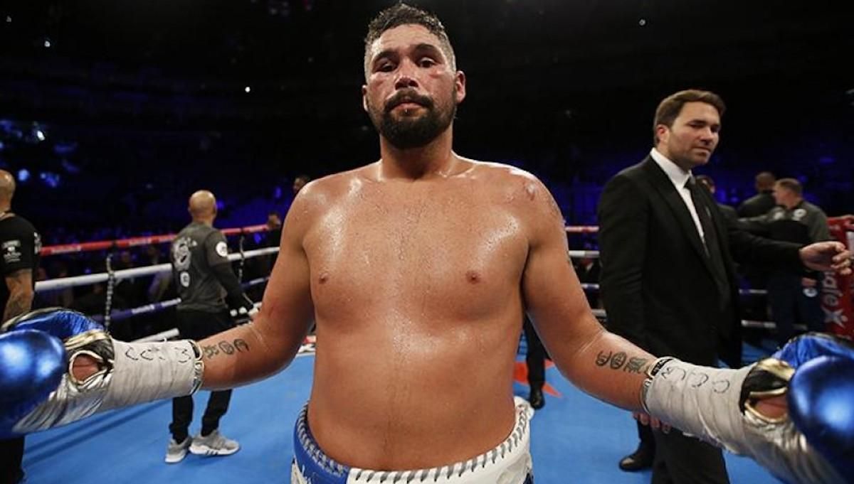 Тоні Белью / фото з відкритих джерел