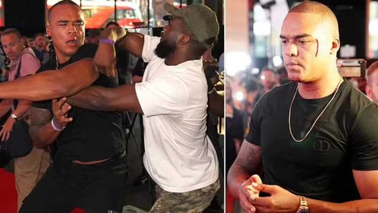 Фабіо Вордлі отримав пошкодження / колаж Dailymail Фабіо Вордлі отримав пошкодження / колаж Dailymail