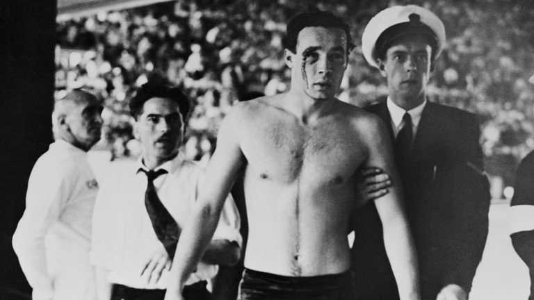 Закривавлений Ервін Задор / Фото Getty Images Закривавлений Ервін Задор / Фото Getty Images