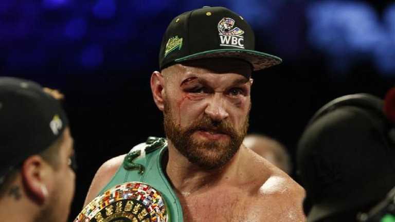 Тайсон Фьюри / Фото REUTERS/Steve Marcus Тайсон Фьюри / Фото REUTERS/Steve Marcus