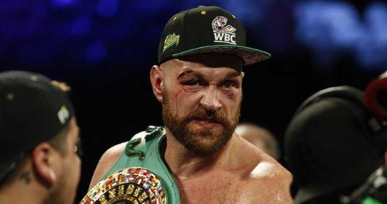 Тайсон Фьюри / Фото REUTERS/Steve Marcus