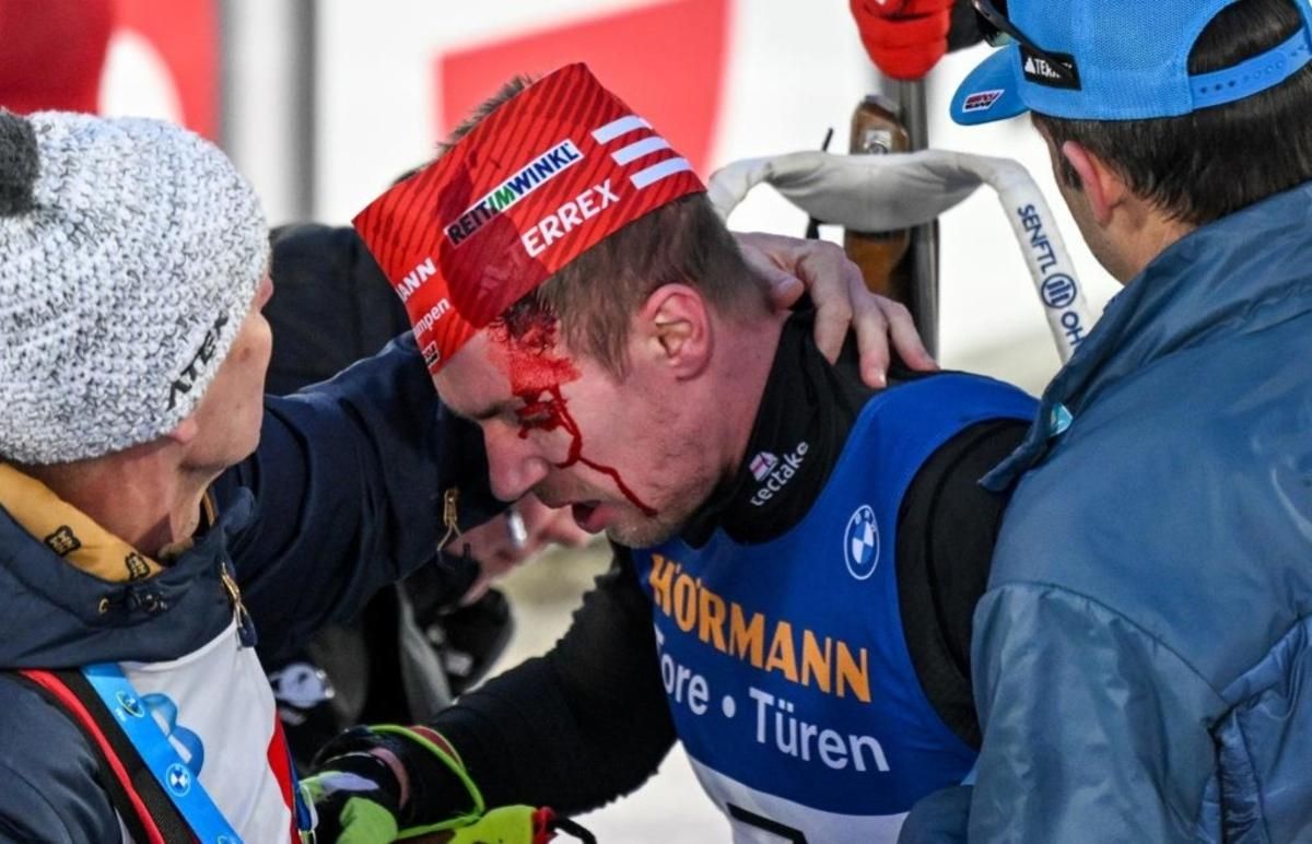 Йоганнес Кюн після падіння / Фото DPA