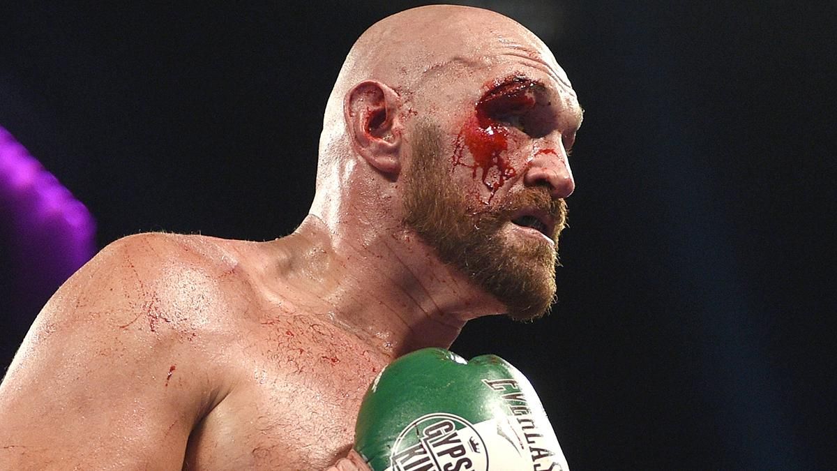 Тайсон Фьюри / Фото: Getty Images
