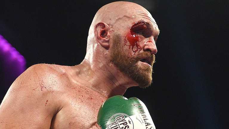 Тайсон Ф'юрі / Фото: Getty Images Тайсон Ф'юрі / Фото: Getty Images