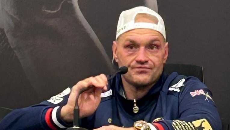 Тайсон Ф'юрі / Скриншот прес-конференції Тайсон Ф'юрі / Скриншот прес-конференції