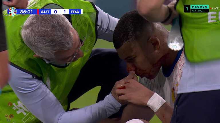 Австрія - Франція / скріншот транслції Австрія - Франція / скріншот транслції