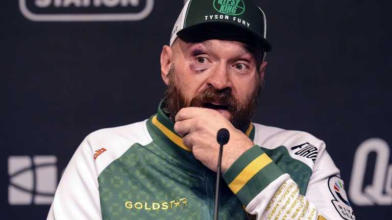 Тайсон Ф'юрі / Getty images Тайсон Ф'юрі / Getty images