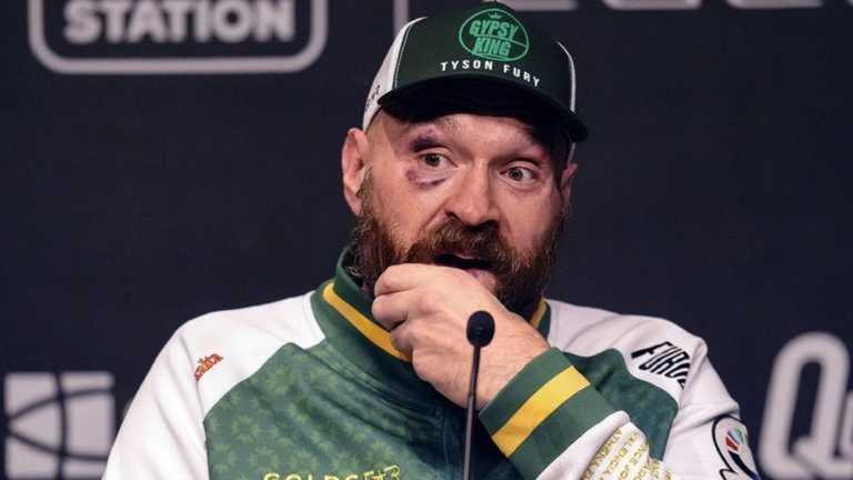 Тайсон Ф'юрі / Getty images Тайсон Ф'юрі / Getty images