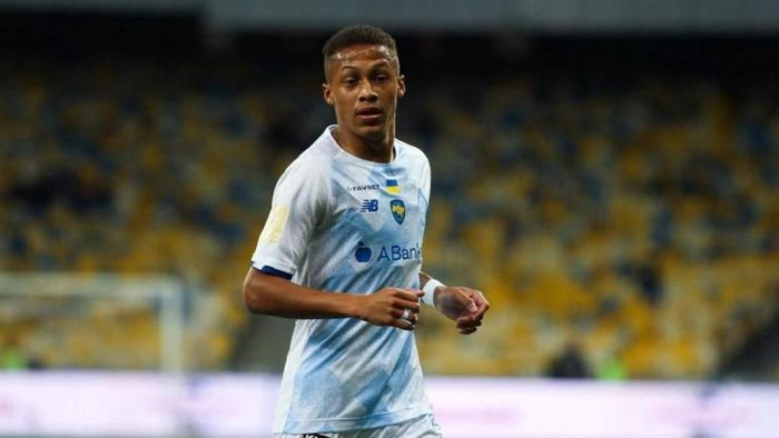 Легіонер Динамо зламав лікоть – відомі терміни відновлення 