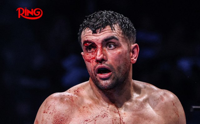 Непереможний боксер програв у кривавій битві з жахливим розсіченням – моторошні кадри