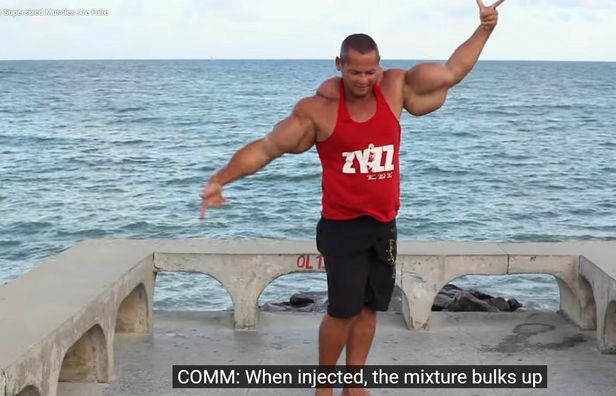 Раптово помер бразильський бодібілдер, який експериментував з небезпечними вакцинами
