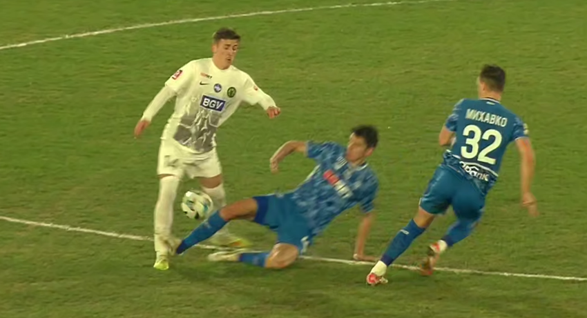 Скандал після матчу Полісся – Динамо: житомиряни показали ногу гравця після жорсткого підкату Біловара (ФОТО)