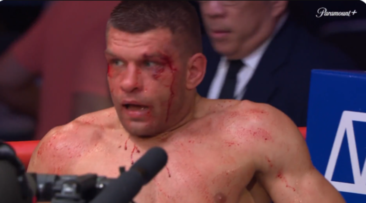 Хекетт та Деревʼянченко / Фото Ed Mulholland/Zuffa Boxing